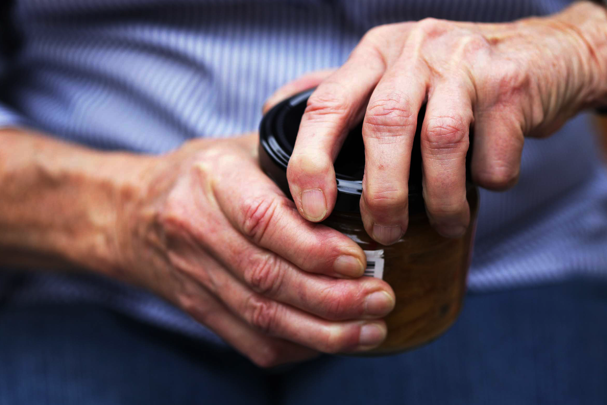 Understanding arthritis, it’s risk factors and treatment