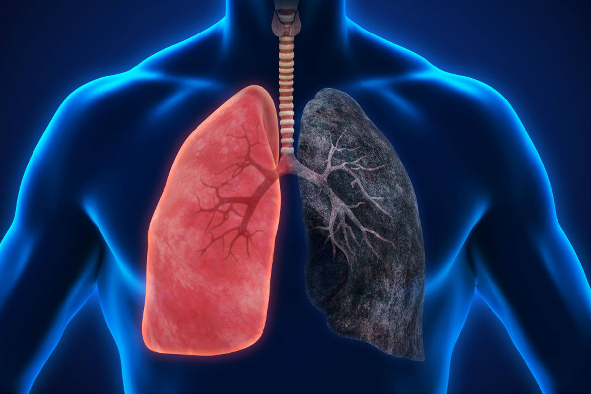 How Cigarette Smoking can affect your Lungs - Regency Healthcare