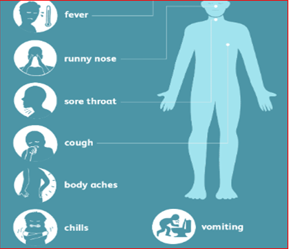 signs of swine flu