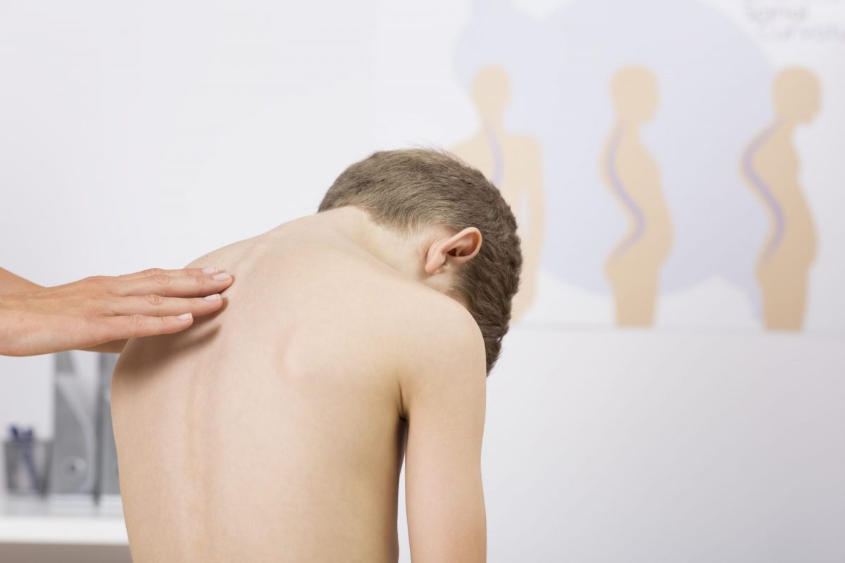 Adolescent idiopathic scoliosis