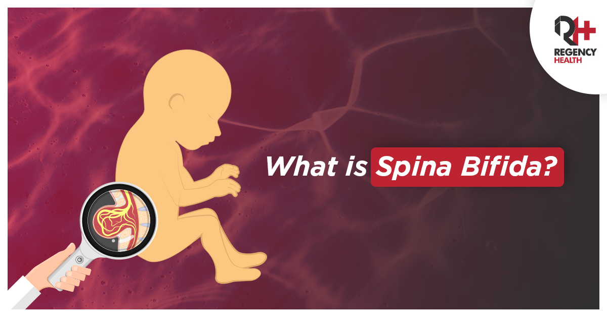 Spina Bifida Causes Symptoms Types Diagnosis And Treatment 8108