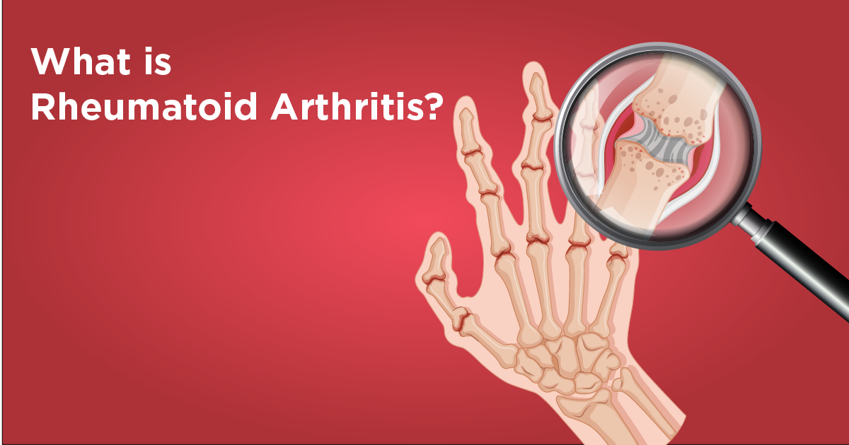 What is Rheumatoid Arthritis (RA)? - Blog - Regency Healthcare Ltd