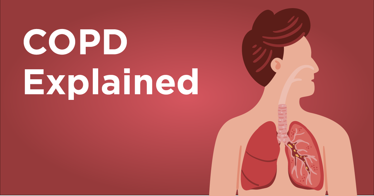 chronic obstructive pulmonary disease causes