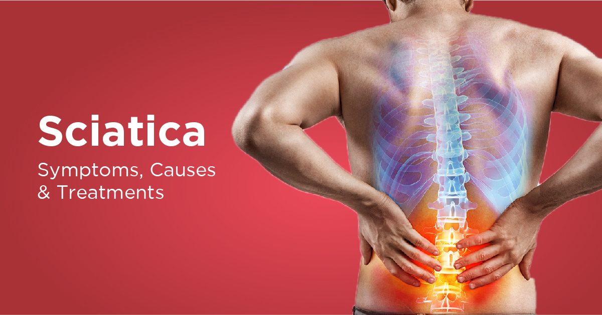 Sciatica Symptoms Causes Treatments Prevention