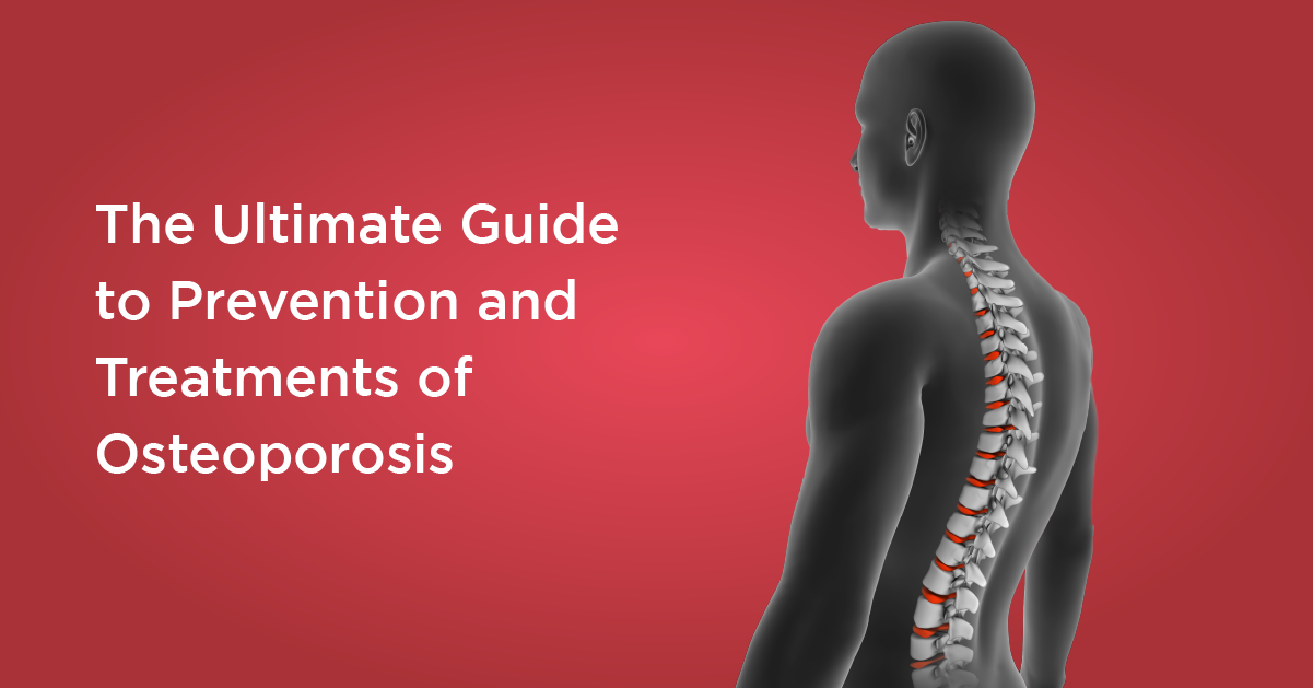 The Ultimate Guide to Prevention and Treatment of Osteoporosis