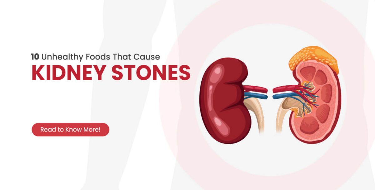 What-are-the-10-Foods-that-Cause-Kidney-Stones-1200x608.jpg