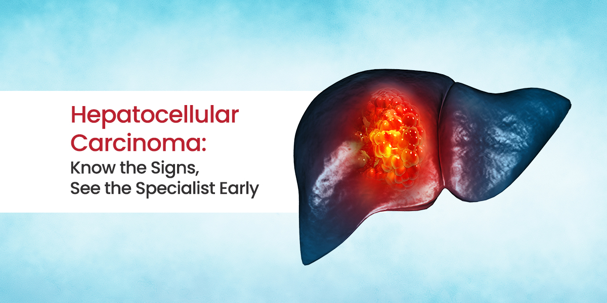 Hepatocellular-Carcinoma-Symptoms.jpg
