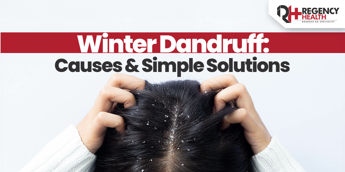 Dandruff.jpg