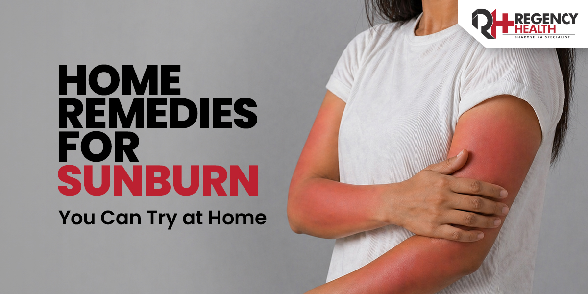 Home-Remedies-for-Sunburn.jpg