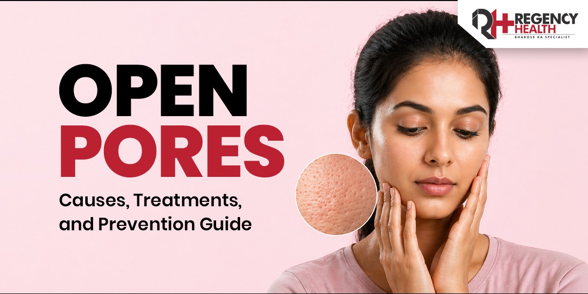 Open-Pores.jpeg