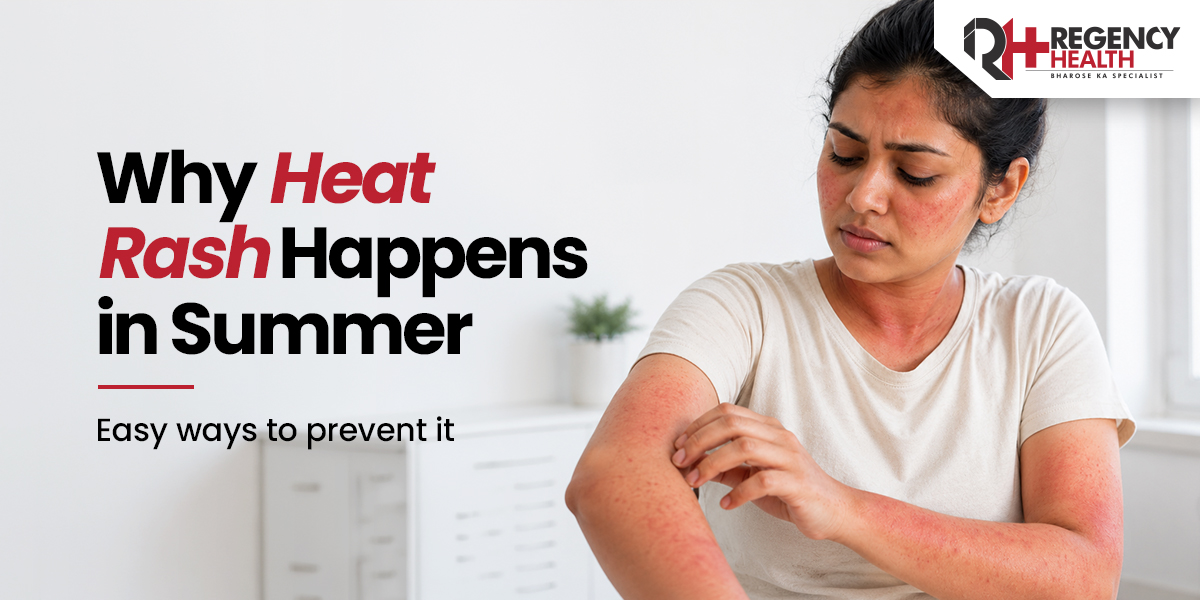 Why-Heat-rash-happen-in-summer.jpeg