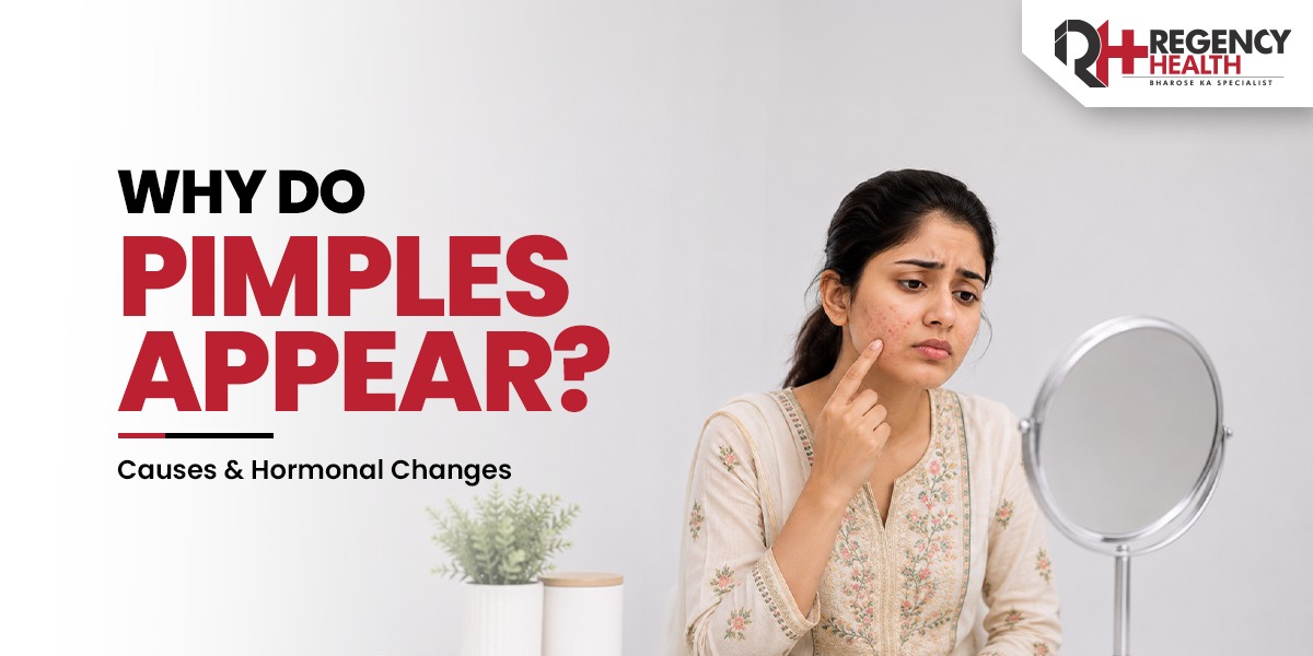 Why-do-pimple-appers.jpeg