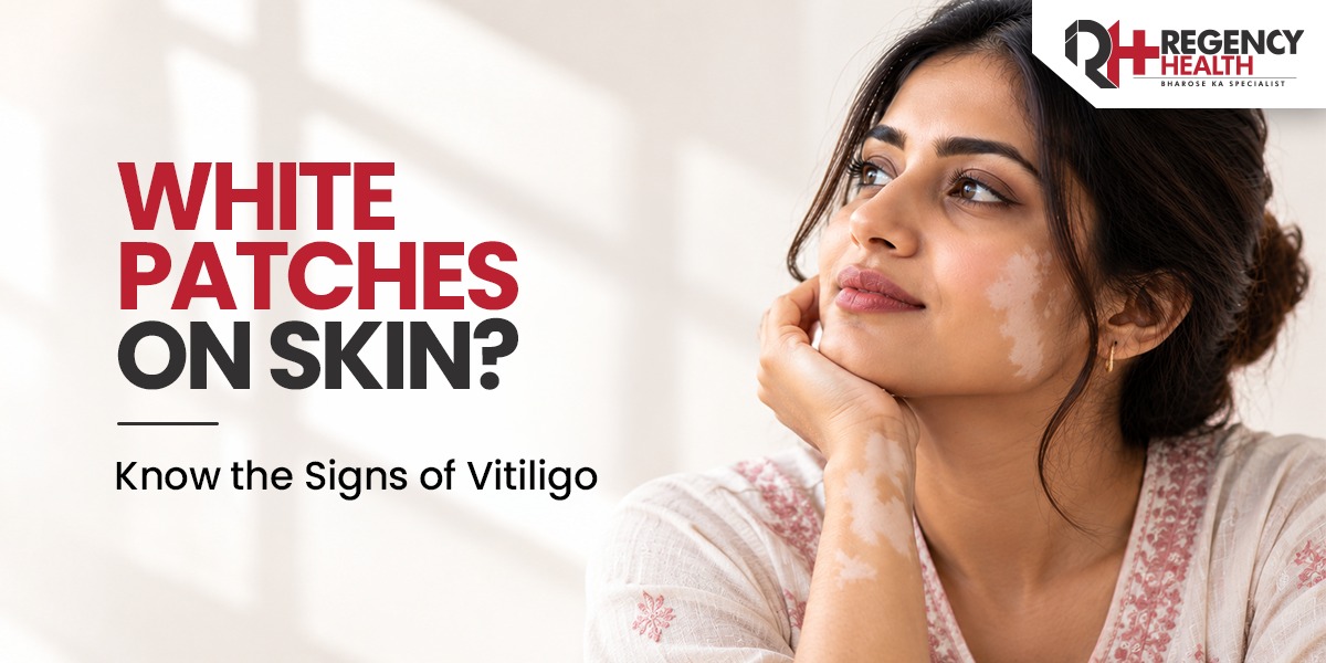vitiligo​.jpeg